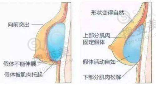 广州打普丽妍针多少钱？价格受多因素影响，部分公立医院参考价有波动 