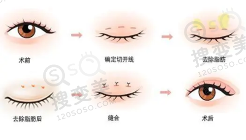 2025广州吕方中收费明细之医生口碑见证