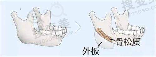 莫志波医生在广州排第几名？鼻修复前三，技术优口碑好需提前预约 
