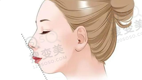 吕方中高难度眼修复真实范例曝光:口碑良好无黑料