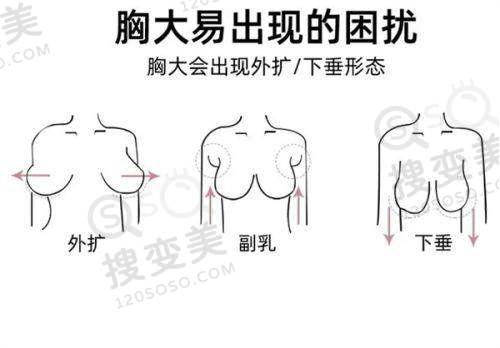 眼修复吕方中怎么预约——现场加号方式