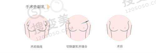 广州馒化修复价格收费标准2025:医院选择避坑指南
