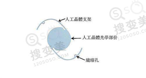吕方中高难度眼修复真实范例曝光:擅长项目多样