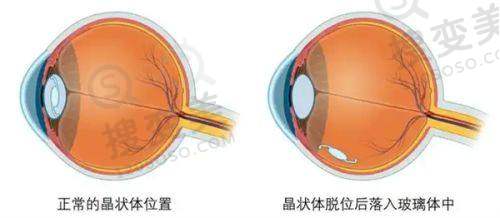 谁说广州新市医院骗局？——医院靠谱之处解读