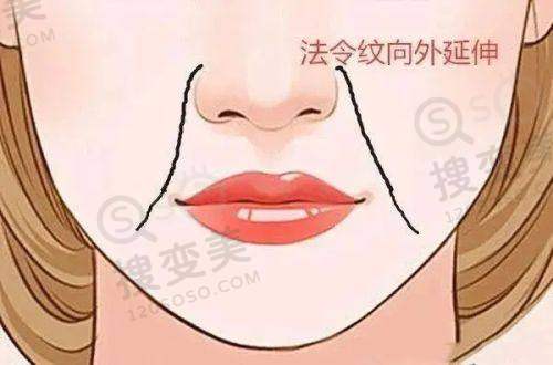 告别"叔感"眼袋!2025广州专精做男士去眼袋的十大医院之常见去眼袋方法