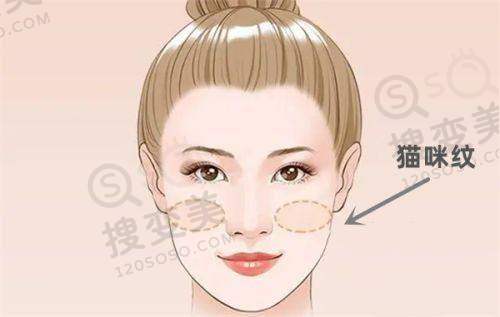 钟杰光医生做泪沟馒化修复手术的口碑评价