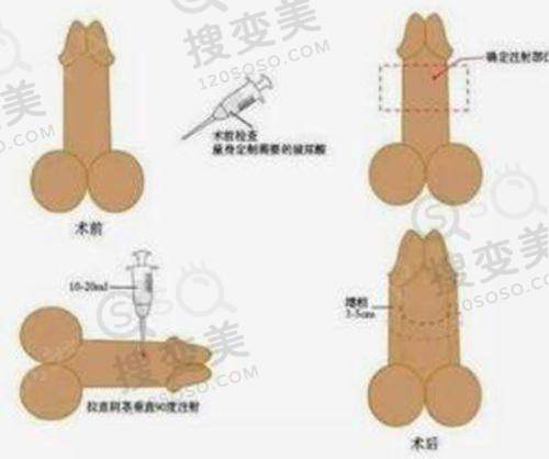 吕方中为什么经常换医院？香港顾客对其技术的高度评价