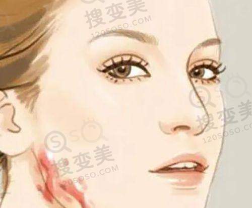 2025广州新市医院整形美容科价目表之身体塑形价格
