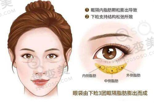2025广州馒化脸修复好的医生推荐之余文林医生