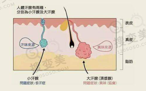 钟杰光医生做泪沟馒化修复手术的核心技术