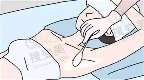 谁说广州新市医院骗局？——钟杰光医生取异物佳绩