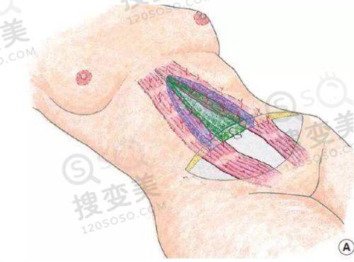 吕方中高难度眼修复真实范例曝光:成功实例众多