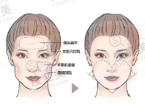 广州双眼皮王擎医生简介，南方医科整形博士擅五官整形，口碑佳