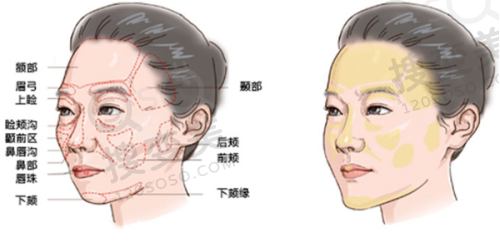 广州增城牙科门诊收费价格表 - 增兴牙科医院收费价格对比