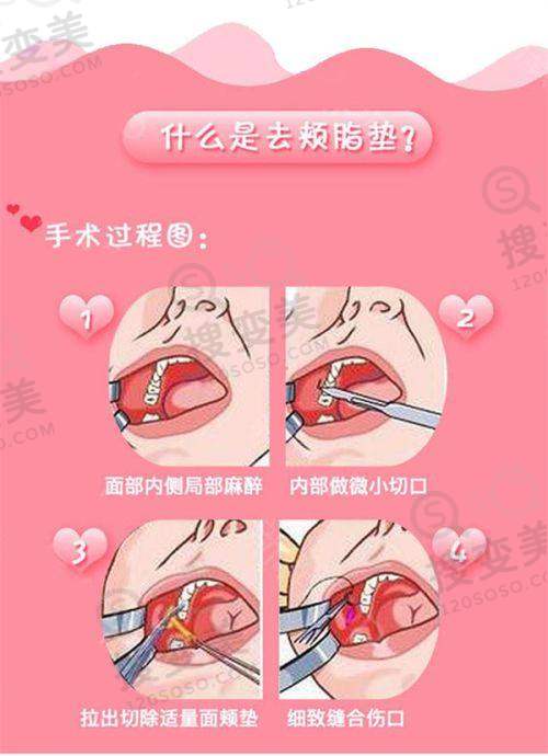 吕方中医生坐诊城市2025真相之眼修复技术优势