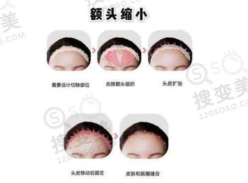 吕方中医生在深圳哪家整形医院的患者血泪史及识别方法