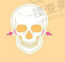 广州打普丽妍针多少钱：多部位注射价格细分