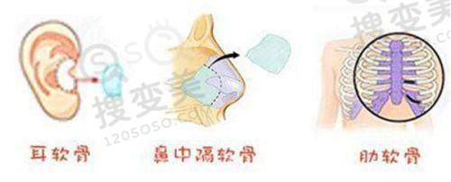 吕方中和沈海燕哪个好？技术特色大比拼