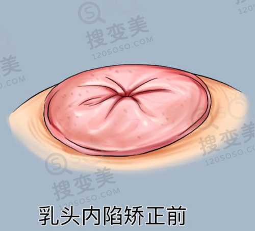 北京广济疤痕医院正规吗——可靠设备方面