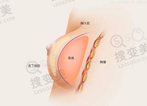 刘学宝医生擅长项目