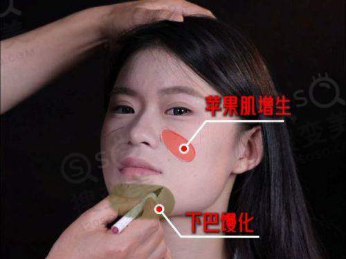 紫馨美容之黑科技矩阵