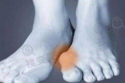 贵阳华医医院疤痕专科:温馨环境与贴心服务