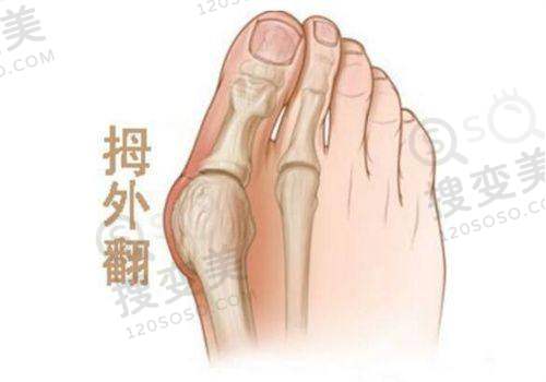眼科骨干医生在线问诊：深圳地区的免费询问服务