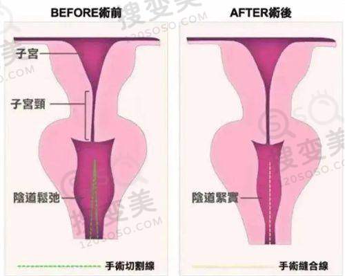 兰州普瑞眼科预约挂号