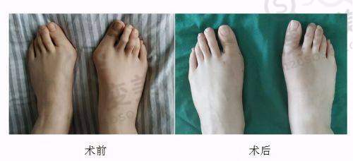 成都军大整形医院是正规医院吗?——口碑见证医院实力