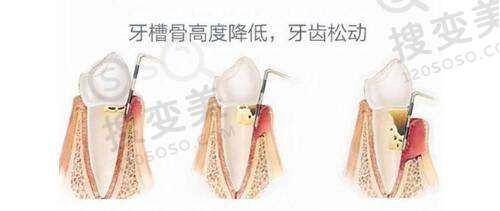 长春中妍整形医院鼻部整形价格