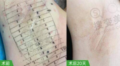 韩妃医美旗下广州分院的正规性与实力
