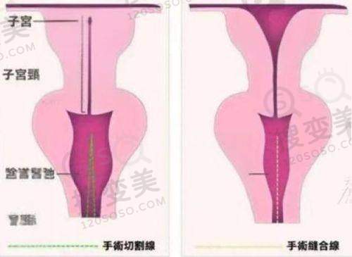 商洛眼科医院上班时间之异地复诊服务安排