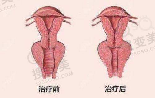 飞秒秒眼科医院杭州总院的顾客口碑
