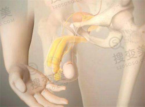 杜太超医生的Caw小切口拉皮术术后成效