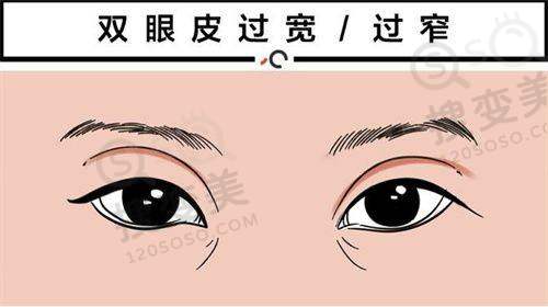 广州海峡整形的口碑评价