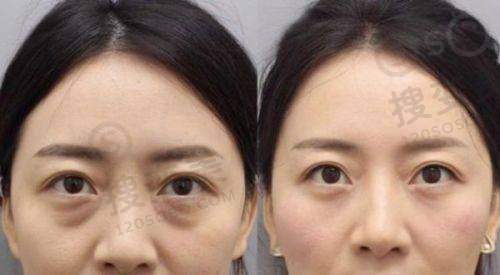 汕头汕美医疗美容医院的项目与价格