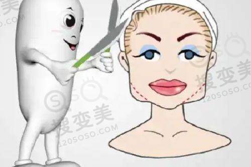双眼皮修复哪里做的更好之魏志香医生与北京丽星翼美医疗美容
