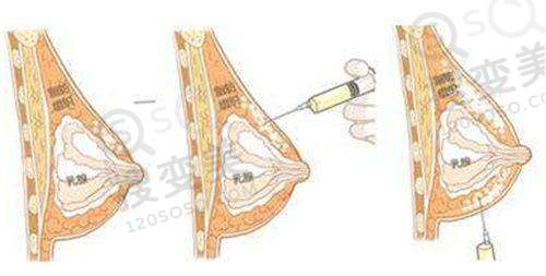 宝宝龋齿治疗及补救方法蛀牙图片参考