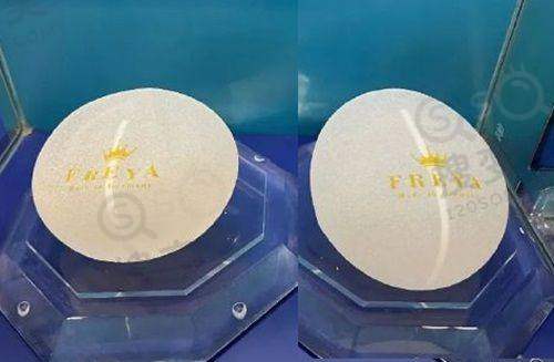 套筒冠义齿的医生团队优势