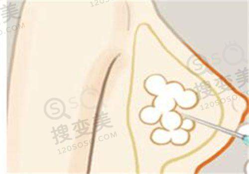 瑞丽整形美容医院价格表曝光！多城分院项目收费透明，口碑良好 