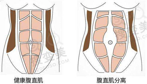 什么型的B更好?——阴唇形态对性生活的影响