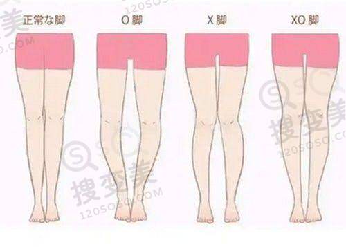 厦门口腔门诊之正畸情况