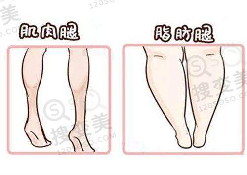 泰国整形医院在线询问：其他医院及项目