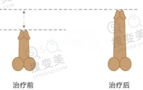 广州曙光医学美容医院的技术实力