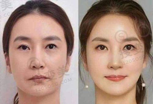成都成美之疤痕修复中 心优势