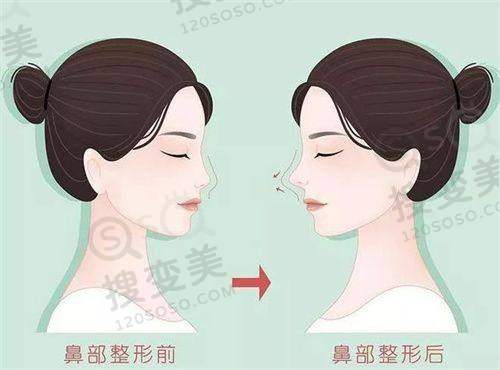 博球口腔医院的价格体系合理性