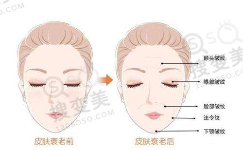 盆底肌修复哪家医院好——郑州中医药大学第一附属医院