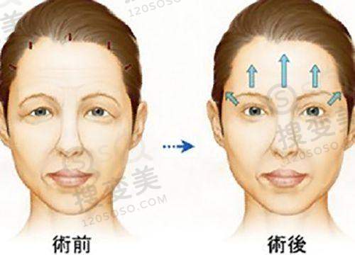 北京广济疤痕医院正规吗——口碑评价方面
