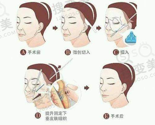 金华瑞丽整形医院价格表解读