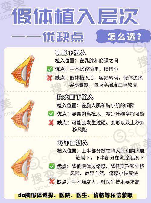 爱尔眼科医院近视手术技术优势与口碑情况